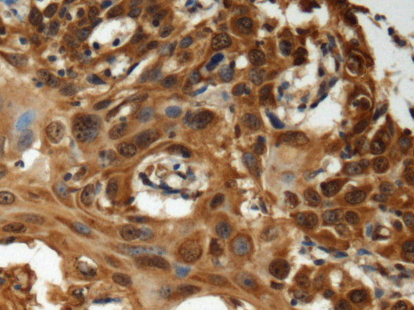 Rabbit Polyclonal Antibody to HLA-DOA