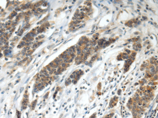 Rabbit Polyclonal Antibody to HEPH
