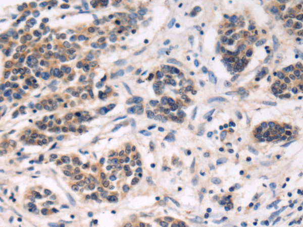 Rabbit Polyclonal Antibody to DIP2A