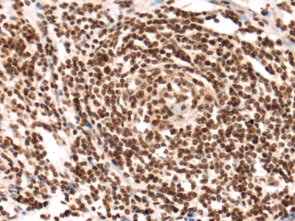 Rabbit Polyclonal Antibody to FBXL21P