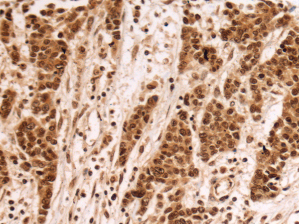 Rabbit Polyclonal Antibody to FBXL17