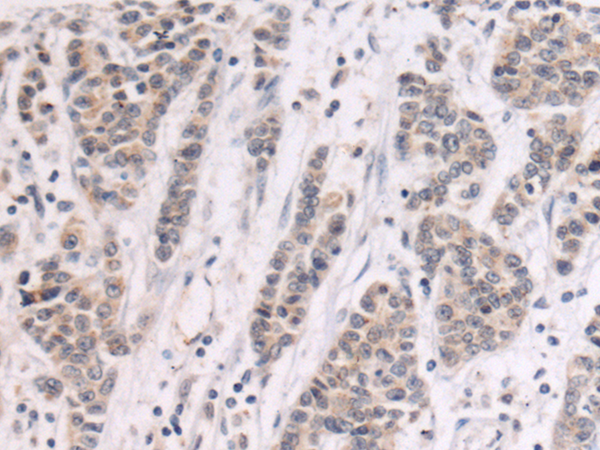 Rabbit Polyclonal Antibody to GALNT3