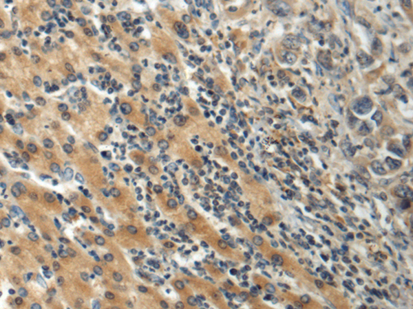 Rabbit Polyclonal Antibody to FBXO11