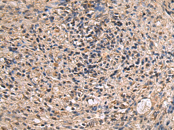 Rabbit Polyclonal Antibody to ITIH2