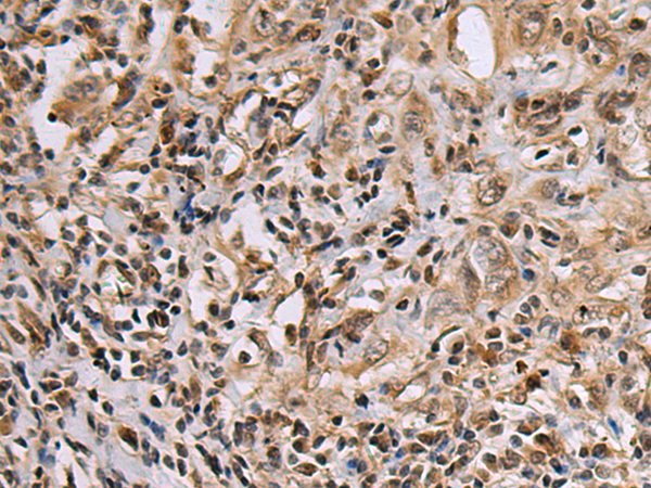 Rabbit Polyclonal Antibody to DNA2