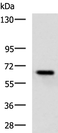 Rabbit Polyclonal Antibody to KBTBD8