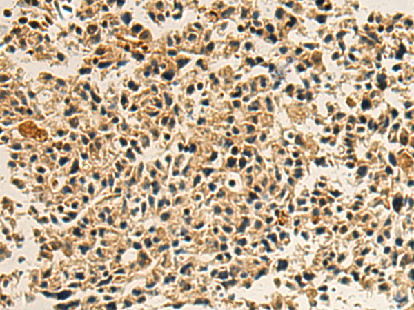 Rabbit Polyclonal Antibody to ERMAP