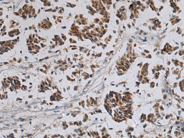 Rabbit Polyclonal Antibody to TSSK4