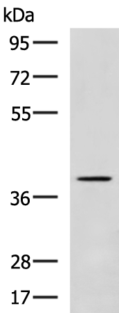 Rabbit Polyclonal Antibody to POLB