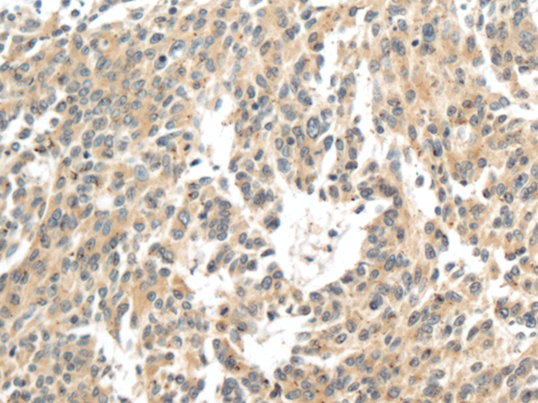 Rabbit Polyclonal Antibody to FBXO34
