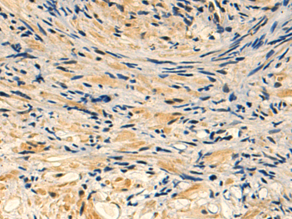 Rabbit Polyclonal Antibody to AZIN2