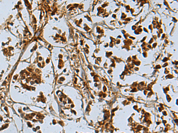 Rabbit Polyclonal Antibody to NR5A1