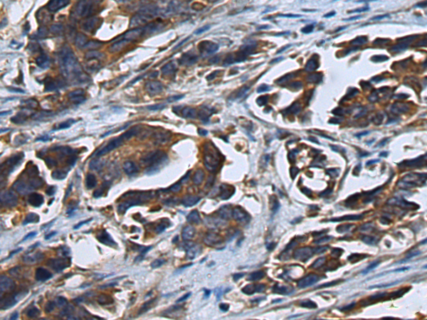 Rabbit Polyclonal Antibody to SIL1