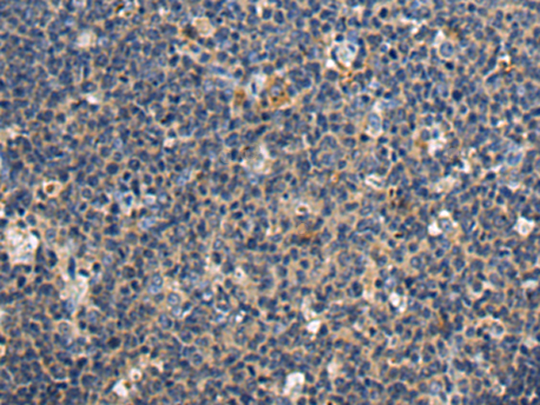 Rabbit Polyclonal Antibody to FMO2