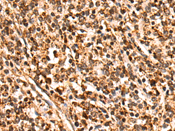Rabbit Polyclonal Antibody to SCARB2