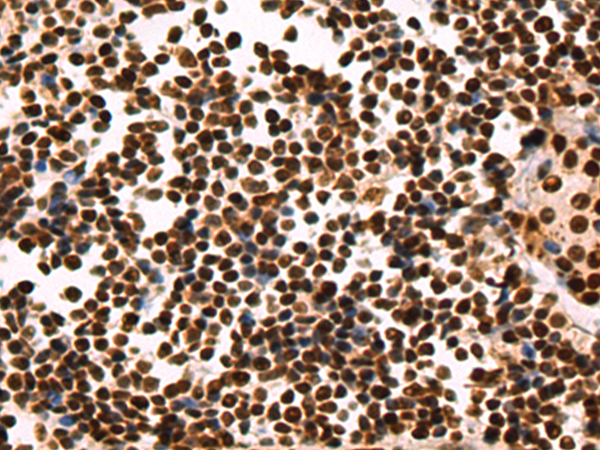 Rabbit Polyclonal Antibody to NCL