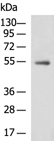 Rabbit Polyclonal Antibody to ZNF639