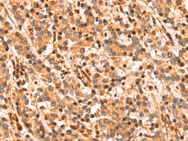 Rabbit Polyclonal Antibody to KLHL29