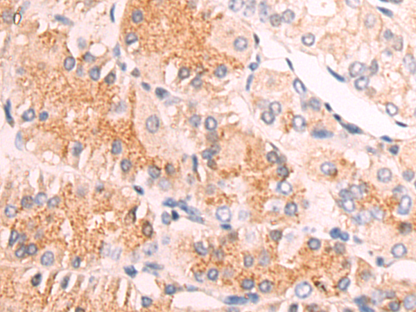 Rabbit Polyclonal Antibody to MYOC