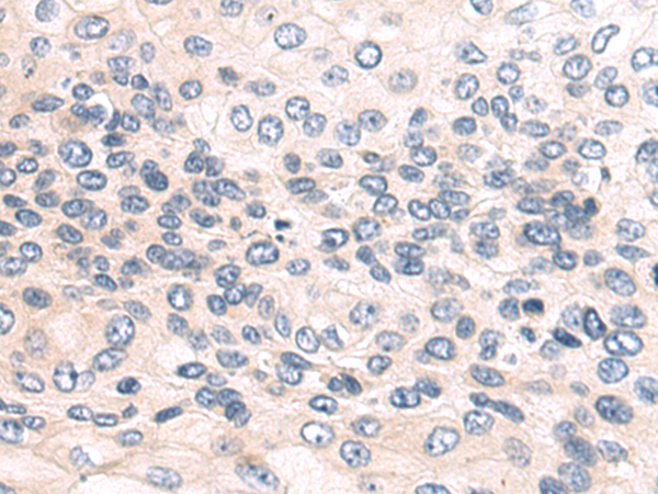 Rabbit Polyclonal Antibody to USP30