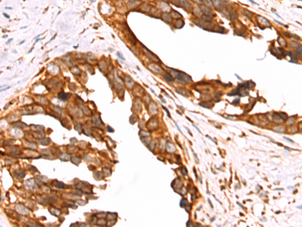 Rabbit Polyclonal Antibody to JADE1