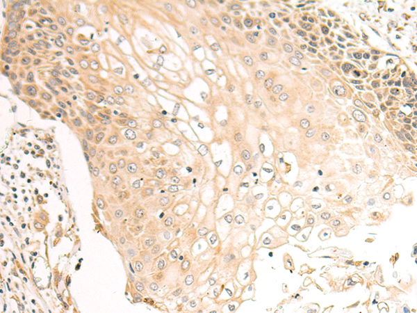 Rabbit Polyclonal Antibody to P4HA2