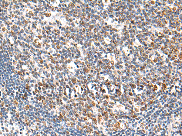 Rabbit Polyclonal Antibody to KPNA6