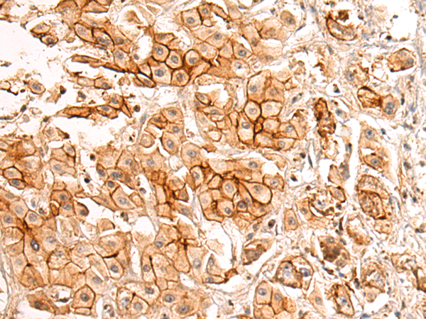 Rabbit Polyclonal Antibody to PALMD