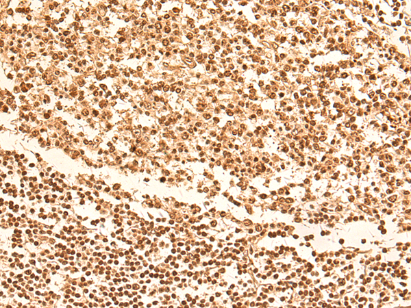 Rabbit Polyclonal Antibody to UIMC1