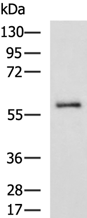 Rabbit Polyclonal Antibody to ABHD16A
