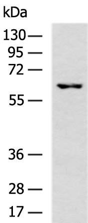 Rabbit Polyclonal Antibody to CES1