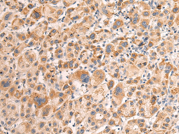 Rabbit Polyclonal Antibody to IHO1