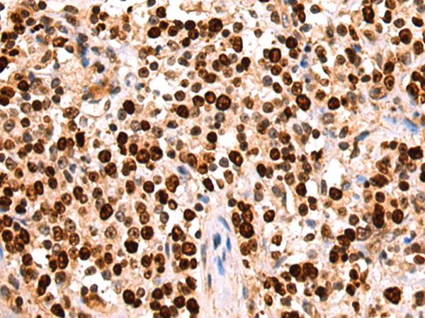 Rabbit Polyclonal Antibody to MKI67