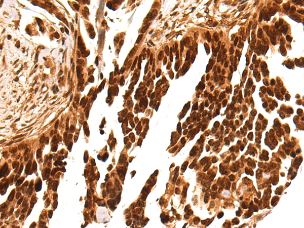 Rabbit Polyclonal Antibody to LRWD1