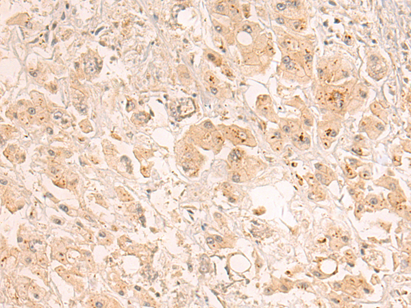 Rabbit Polyclonal Antibody to ZDHHC5