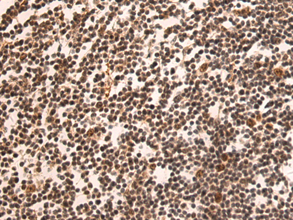 Rabbit Polyclonal Antibody to LEO1