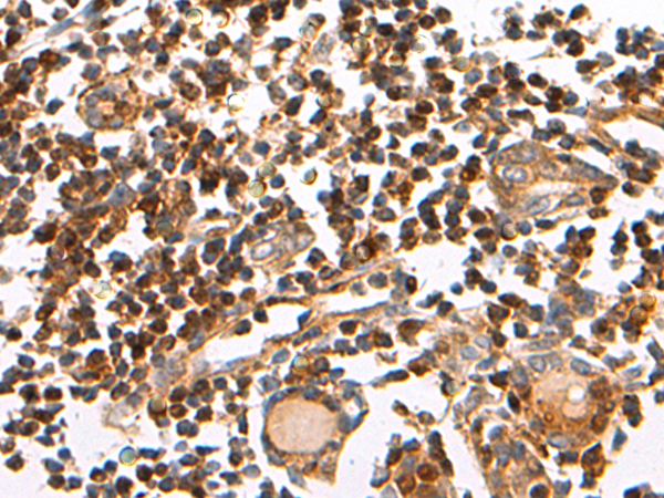 Rabbit Polyclonal Antibody to SHCBP1