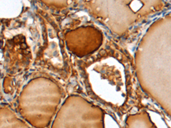 Rabbit Polyclonal Antibody to MID2