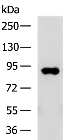 Rabbit Polyclonal Antibody to PLOD3