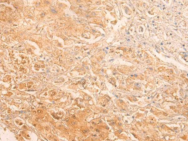 Rabbit Polyclonal Antibody to MMUT
