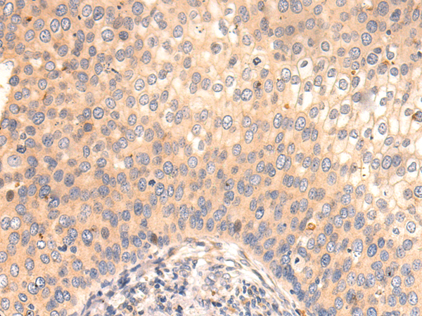 Rabbit Polyclonal Antibody to ARF5