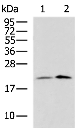 Rabbit Polyclonal Antibody to RPS10