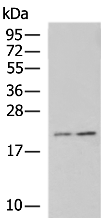 Rabbit Polyclonal Antibody to PLLP
