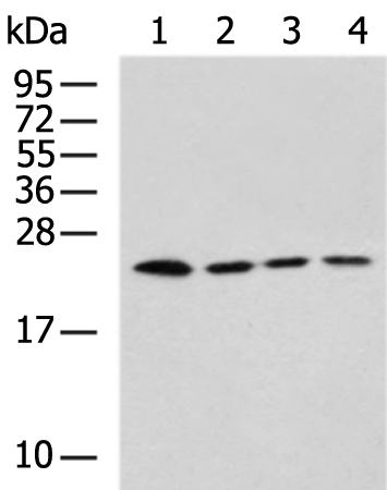 Rabbit Polyclonal Antibody to RPS7
