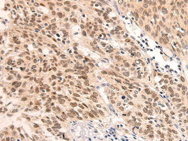 Rabbit Polyclonal Antibody to MED18