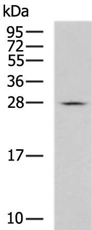 Rabbit Polyclonal Antibody to TRPT1