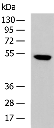 Rabbit Polyclonal Antibody to PRPF19