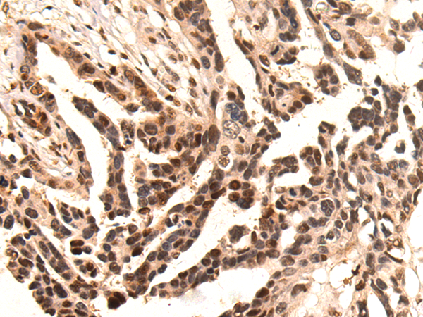 Rabbit Polyclonal Antibody to KPNA1