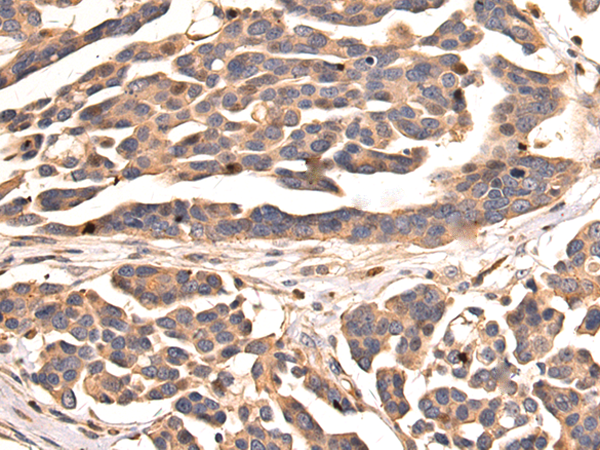 Rabbit Polyclonal Antibody to PDZK1