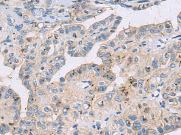 Rabbit Polyclonal Antibody to DHTKD1